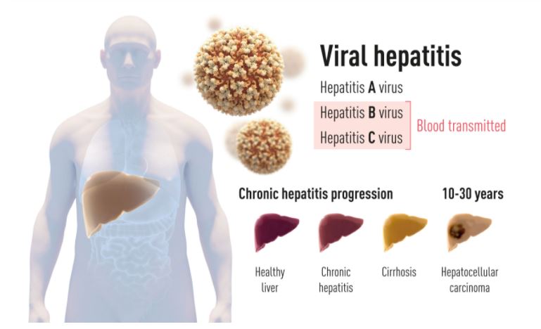 051815072wuo.jpg 051815072wuo.jpg